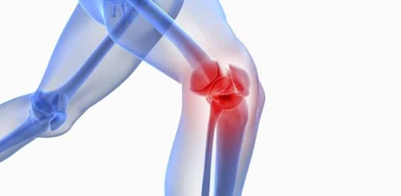 kNEE
